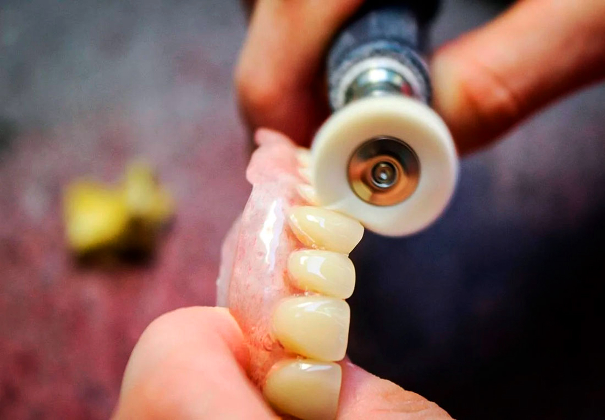 ремонт и изготовление зубных протезов